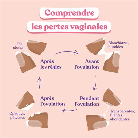 perte blanche infection|Perte blanche : tout savoir sur la leucorrhée chez la。